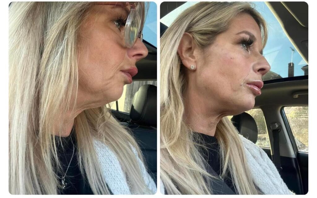 dynamic wrinkle