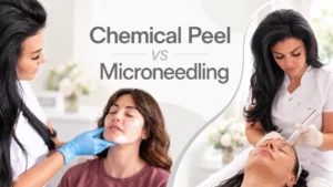 Chemical Peel vs Microneedling